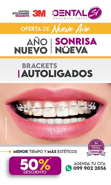 MAILING DENTAL SÍ BRACKETS DENTADURA-01